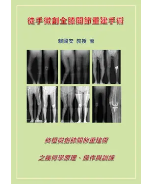 書封 徒手微創全膝關節重建手術：終極微創膝關節重建術之幾何學原理、操作與訓練